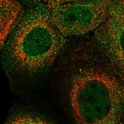 SNX22 Antibody, Novus Biologicals 0.1mL; Unlabeled:Antibodies, Polyclonal